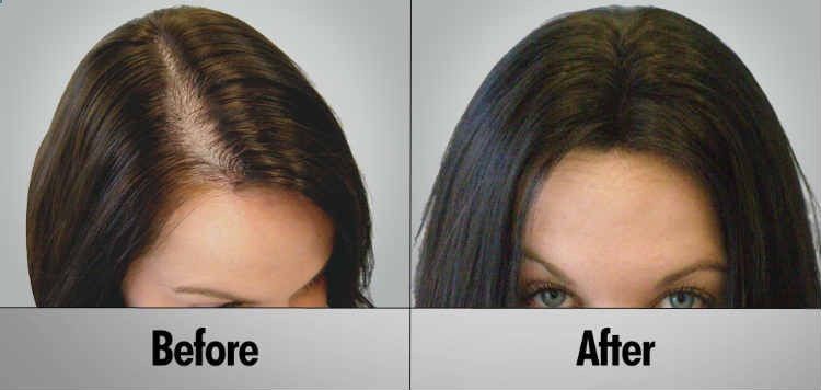 Rejuvalex Hair Growth Formula